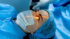 Are You Awake During Laser Eye Surgery? What to Expect