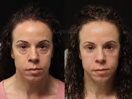 Re-introducing my rock star physician assistant