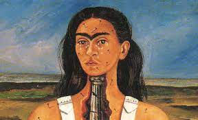 The iconic painter frida kahlo. Frida Kahlo The Broken Column Dailyartmagazine Com Art History Stories