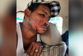 Brandón mayorga, 23, from nicaragua juventus managua fc, since 2019 goalkeeper market value: Ricardo Mayorga Attacked And Bloodied At Gas Station Photo Boxing News
