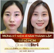 LỜI ĐỒN: Cắt mí đau lắm, lại nhìn "giả trân", tốn tiền, mất thời gian mà