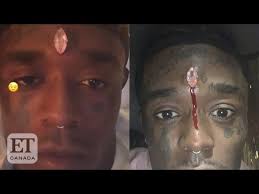 Jun 02, 2021 · lil uzi vert has removed the $24m (approximately £17m) diamond that was implanted in his forehead, three months after unveiling the ostentatious accessory. Lil Uzi Vert Gets Diamond Piercing In Forehead Youtube