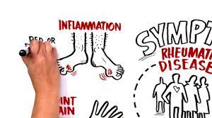 Rheumatology Specialty Center Rheumatic Disease Associates In Pa