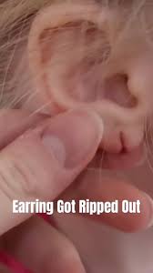 Inside Edition | Little Amiah Hankins got her ears pierced for her fourth  birthday. A few weeks later, the little girl swallowed one of the earrings.  The... | Instagram