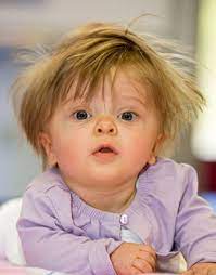 Rare Disease Day 2021 Article
