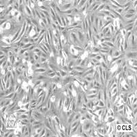 The 'vero' lineage was isolated from kidney epithelial cells extracted from an african green monkey (chlorocebus sp.; Monkey Cell Lines Cls Online Shop