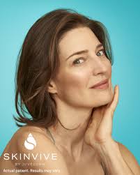 ✨Time to glow!✨ SKINVIVE by JUVÉDERM® is an injectable hyaluronic acid gel  designed to increase hydration to improve cheek skin smoothness for a  lasting glow.* Ready to glow? Call our office to