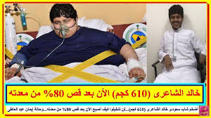 أضخم شاب سعودى خالد الشاعرى 610 كجم لن تتخيلوا كيف أصبح الأن بعد قص 80 من معدته وحالة إيمان عبد العاطى تعرف على التفاصيل baseball cards baseball sports