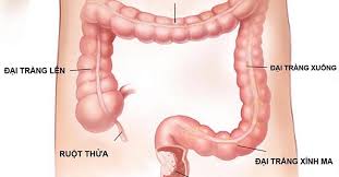 Ung thư dạ dày như bạn đã biết là căn bệnh nguy hiểm thường gặp trong các loại bệnh ung thư về đường tiêu hóa. Viem Ä'áº¡i Trang La Gi Náº±m á»Ÿ Ä'au Nguyen Nhan Dáº¥u Hiá»‡u Va Cach Chá»¯a Bá»‡nh