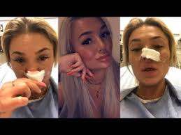 NEW YEAR'S NIGHTMARE: Woman's boyfriend allegedly bites her nose off