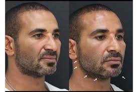 أحمد سعد وريم البارودى يهربان من عيد الأضحى أعلنت الشركة المنتجة لفيلم خطيب مراتى، الذى يشارك فى بطولته أحمد سعد، وريم البارودى، تأجيل طرحه إلى بعد انتهاء موسم عيد الأضحى السينمائى المقبل. Ø±ÙŠÙ… Ø§Ù„Ø¨Ø§Ø±ÙˆØ¯ÙŠ ØªØ¹Ù„Ù‚ Ø¨Ù„ÙØ¸ Ø®Ø§Ø±Ø¬ Ø¹Ù„Ù‰ ØµÙˆØ±Ø© Ø£Ø­Ù…Ø¯ Ø³Ø¹Ø¯ Ø§Ù„Ù…ØµØ±ÙŠÙˆÙ†