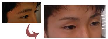 ãçã«ãããã®ç»åæ¤ç´¢çµæ