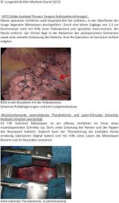 Lungenmetastasen Chirurgie Pdf Free Download