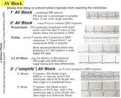 Conduction Blocks at the AV Node (AV Blocks) [With Examples] - Manual of  Medicine