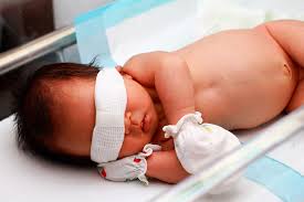Causes and types of jaundice explained | baby gooroo