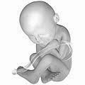 Check spelling or type a new query. Fetus Wikipedia