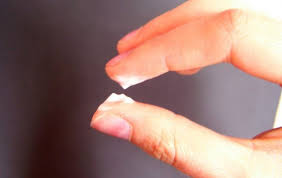 Milky White Discharge Milky White Discharge Causes Of White Discharge Cervical Mucus
