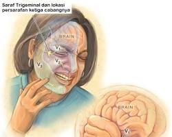 Image of Anatomi Saraf Trigeminal dan Cabangnya
