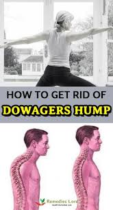 Pin By Bob Grunstein On Back In 2020 Neck Exercises Scoliosis Exercises Dowager Hump
