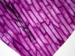 The black sorus is riper than the white one. Typical Plant Cell 40x Magnification Stock Image Image Of Biology School 152965921