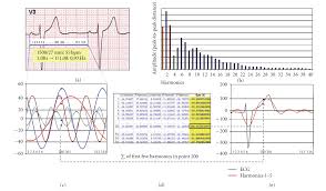 Understanding Ecg Filtering Ems 12 Lead