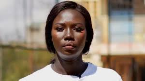 Amavuta ahindura uruhu muri Nigeria: 'Nasigiye inkovu abana banje 6'