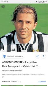 Conte aveva chiesto un rapporto diretto con i giocatori e soprattutto degli stage a coverciano per testare al meglio i giocatori da convocare. En Twitter Ti Abbraccio Fratello