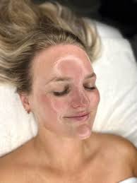 TOP 10 BEST Cupping Therapy near Pismo Beach, CA