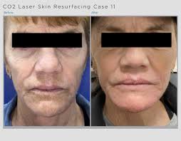 Melissa Kay Burroughs (@melissakaesthetics) • Instagram photos and videos