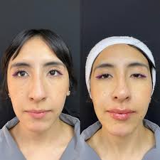 Dra. María del Pilar Alemán