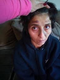 For those whose husband or wife has dementia, have any of you known someone  to divorce for financial reasons? Both a social worker and the lawyer both  told us many people do