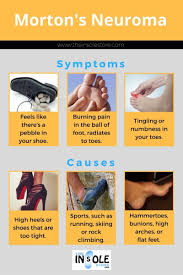 Mortonsneuroma Infographic Www Theinsolestore Com Morton S Neuroma Mortons Neuroma Treatment Foot Reflexology