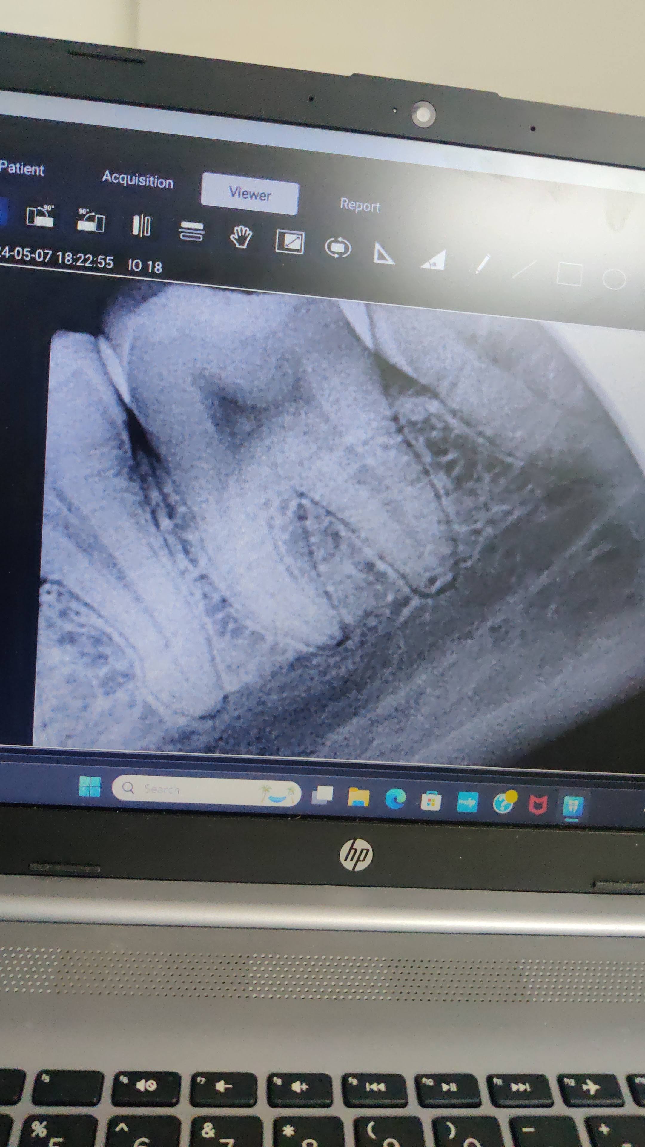 Digital X-ray (RVG) product image