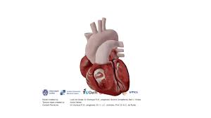 Image result for Atrial Septal Defect