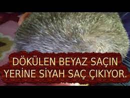 Ibn I Sina Nin Beyaz Saclara Cozum Onerisi Youtube