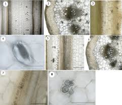 In plant cells vacuoles are large, bounded by a single unit membrane called tonoplast. Pdf Calcium Oxalate Crystal Caox Composition At Different Growth Stages Of Petiole In Vitis Vinifera Vitaceae Semantic Scholar