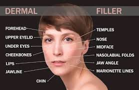 Dermal Fillers