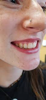 💎✨ New Service at Black Forest Tattoo Co. ✨💎 We're excited to announce  that Katie Johnson is now offering tooth gems right here in the shop! If  you're looking to add a