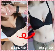 Natural Breast Enhancement Before and After Photos #3 — Give Me Some Boobs!