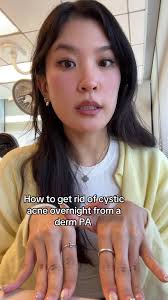 Effective Cystic Acne Treatments from a Dermatology PA