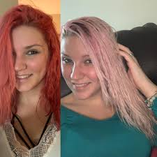 To penetrate the hair shaft, the process has to lift the hair's cuticle. So I Had White Bleached Hair I Decided Red Was My Color Lol Not It Turned Out Pink I Use A Youtube Concoction To Fade Dye Half My Hair Fell Out Like