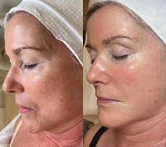 Norfolk Skin Atelier