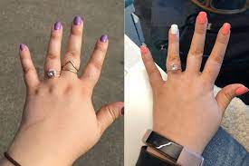 Try a few of these tips to experience some of the fastest weight loss, and then keep your results going by stocking up on the 7 healthiest foods to eat right now. F 29 5 4 173lbs 134lbs 39lbs 1 Year Between Photos The Surprising Way Your Hands Lose Weight My Ring Fits Better And My Scar Has Faded Nicely Progresspics