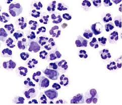 Image result for CSF Blood