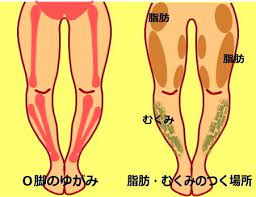 o脚の治し方 ｏ脚 股関節矯正ストレッチ o脚 膝下o脚 腓骨