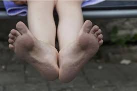 Hampir sama dengan kedutan di leher kanan, kedutan leher sebelah kiri juga memliki makna akan di serang sakit, namun penyakit tersebut akan segera sembuh. Mitos Kedutan Di Telapak Kaki Kiri Pertanda Apakah Ini Sebenarnya Semua Halaman Suar