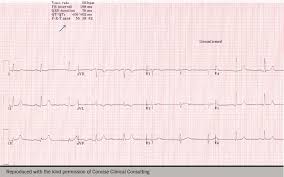 The Art Of Bluffing The British Journal Of Cardiology