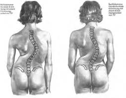 Man hält den adduzierten arm so, dass der daumen nach vorne zeigt und bewegt nun den arm nach vorne (anteversion), danach zur seite. Https Www Ukaachen De Fileadmin Files Klinik Orthopaedie Skript Untersuchungstechniken 18072017 Mod Mt Pdf