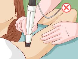 Repeat this dark spots cure to remove black spots on face fast. How To Get Rid Of Dark Armpits 12 Steps With Pictures Wikihow