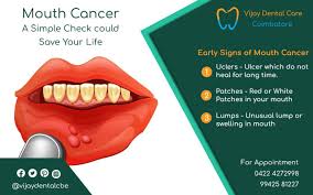 Vijay Dental Care Dental Tourism Dental Posters Dental